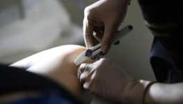 07022026 - Implanon na Atenção Primária - Fotos Matheus Oliveira Agência Saúde DF (1)