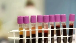 WhatsApp Image 2026-04-06 at 09.34.54