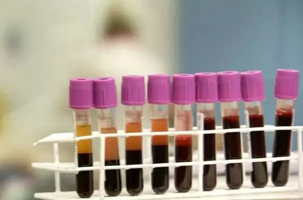 WhatsApp Image 2026-04-06 at 09.34.54